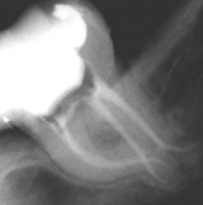 Radiografia durante intervento di endodonzia e cura canalare 