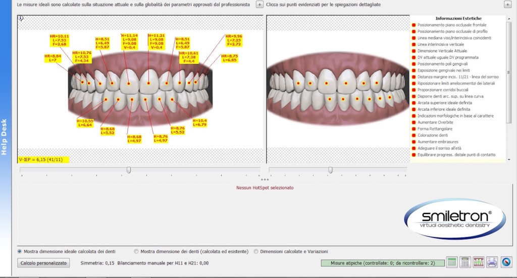 Elaborazione intelligente delle dimensioni dei denti