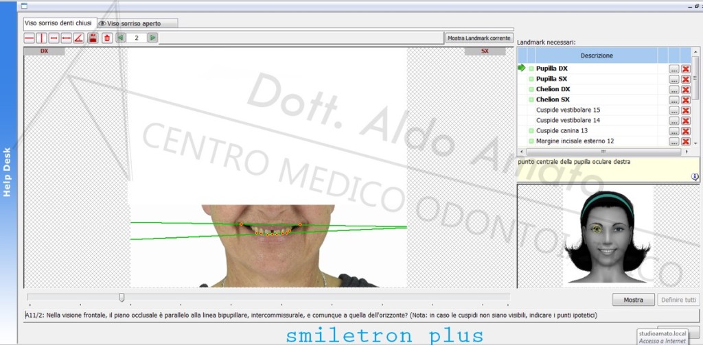 5 Aesthetic case study - oclusal plane