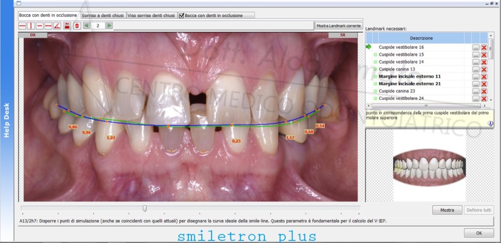 6 Aesthetic case study - smile line