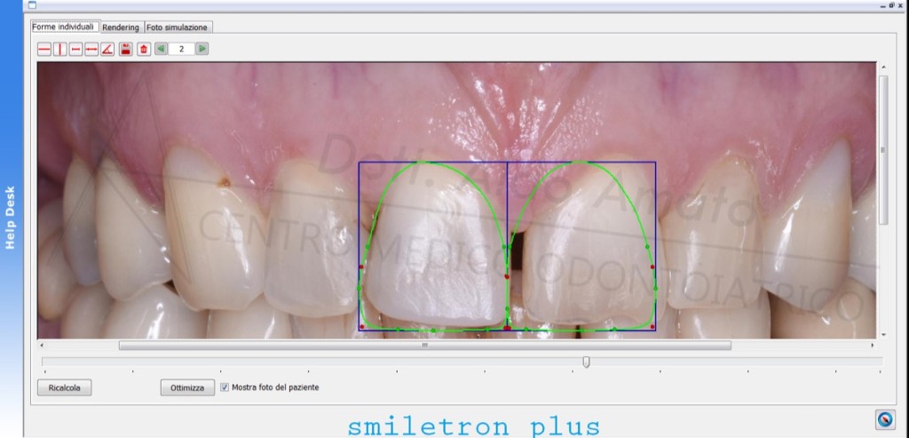 8 Aesthetic case studt - shape elaboration