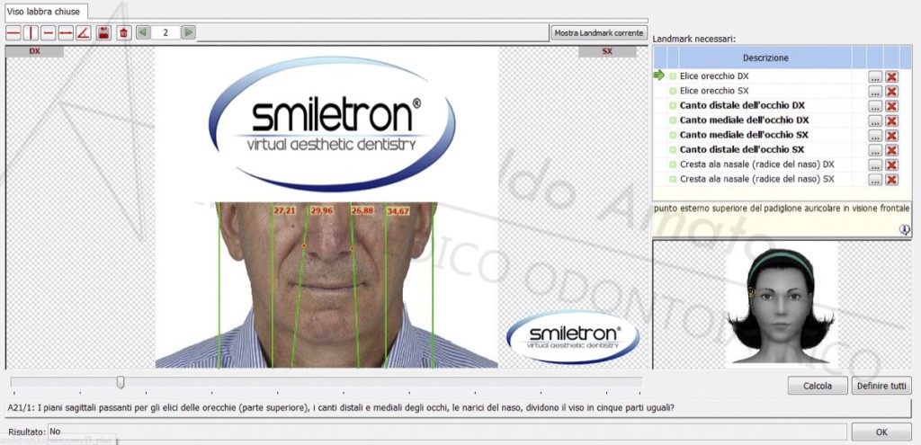 3 con smiletron