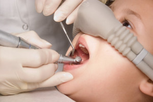 Dentista per bambini: intervento su bambino di 7 anni a Padova