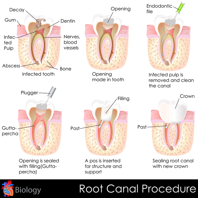 Endodonzia